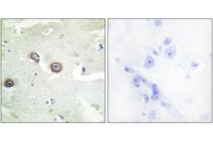 Immunohistochemistry analysis of paraffin-embedded human brain tissue, using CDH4 Antibody. (Cadherin 4 anticorps  (AA 731-780))