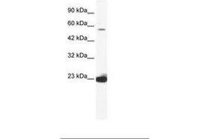 Image no. 1 for anti-DEAD (Asp-Glu-Ala-Asp) Box Polypeptide 55 (DDX55) (AA 468-517) antibody (ABIN202800)
