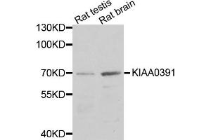 Western blot analysis of extracts of various cell lines, using KIAA0391 antibody (ABIN5971738) at 1/1000 dilution. (KIAA0391 anticorps)
