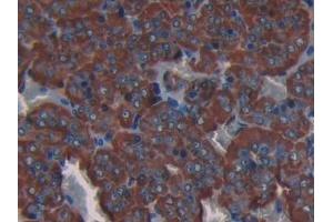 Detection of COL3a1 in Rat Adrenal gland Tissue using Polyclonal Antibody to Collagen Type III Alpha 1 (COL3a1)