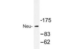 Image no. 1 for anti-Receptor tyrosine-protein kinase erbB-2 (ErbB2/Her2) antibody (ABIN317887) (ErbB2/Her2 anticorps)