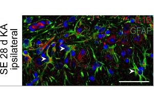 Immunostaining of mouse hippocampal CA1 region showing GFAP and IL1B labeling of astrocytes 28 days after KA-induced status epilepticus (SE). (GFAP anticorps  (AA 411-422))