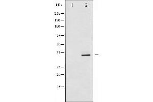 Western blot analysis of CDK2 expression in A2780 whole cell lysates,The lane on the left is treated with the antigen-specific peptide. (CDK2 anticorps  (Internal Region))