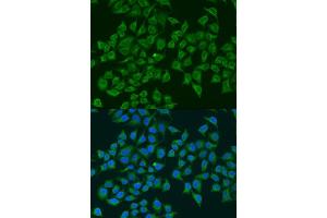 Immunofluorescence analysis of U2OS cells using iNOS antibody (ABIN6129509, ABIN6144728, ABIN6144730 and ABIN6218243) at dilution of 1:100.