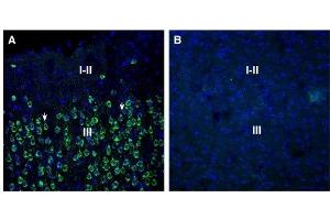 Expression of SORL1 in rat parietal cortex.