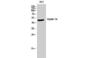 Western Blotting (WB) image for anti-Septin 14 (SEPT14) (C-Term) antibody (ABIN3180873)