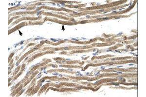 Image no. 1 for anti-Homeobox A10 (HOXA10) (N-Term) antibody (ABIN202418)