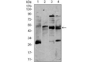 Western blot analysis using CD5 antibody against K562 (1), Jurkat (2), Raji (3), and MOLT4 (4) cell lysate. (CD5 anticorps  (AA 27-233))