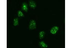 IF analysis of KIFC1 using anti-KIFC1 antibody (ABIN7599523). (KIFC1 anticorps  (AA 1-673))
