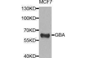 Western blot analysis of extracts of MCF-7 cells, using GBA antibody (ABIN5974589) at 1/1000 dilution. (GBA anticorps)