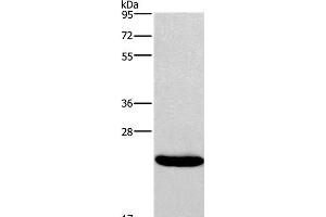 Western Blot analysis of Riji cell using IFNA16 Polyclonal Antibody at dilution of 1:400 (IFNA16 anticorps)