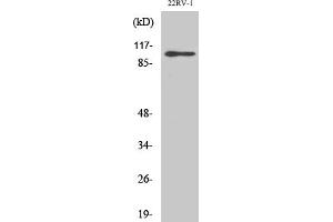 Western Blotting (WB) image for anti-Glutamate Receptor, Ionotropic, AMPA 2 (GRIA2) (Ser880) antibody (ABIN5956617)