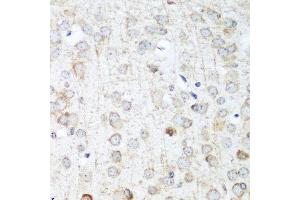Immunohistochemistry of paraffin-embedded mouse brain using ANKRD52 antibody at dilution of 1:100 (40x lens). (ANKRD52 anticorps)