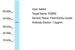 Host: Rabbit Target Name: FCER2 Sample Type: Fetal Kidney lysates Antibody Dilution: 1. (FCER2 anticorps  (C-Term))