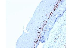 Formalin-fixed, paraffin-embedded human Tonsil-Skin stained with Ki67-Monospecific Mouse Monoclonal Antibody (MKI67/2462). (Ki-67 anticorps  (AA 2293-2478))
