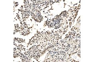 IHC analysis of CPSF6 using anti-CPSF6 antibody (ABIN7601898).