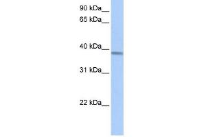 ACADSB antibody used at 1 ug/ml to detect target protein. (ACADSB anticorps  (Middle Region))