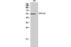 Western Blotting (WB) image for anti-Cytochrome P450, Family 21, Subfamily A, Polypeptide 2 (CYP21A2) (Internal Region) antibody (ABIN6281044)