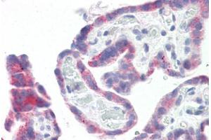 Image no. 2 for anti-G Protein-Coupled Receptor 87 (GPR87) (N-Term) antibody (ABIN6749726)