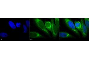 Immunocytochemistry/Immunofluorescence analysis using Mouse Anti-GRP78 Monoclonal Antibody, Clone 1H11-1H7 (ABIN863112).