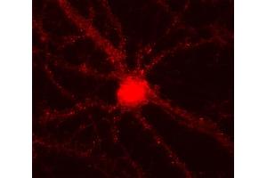 anti-Alpha, beta Synuclein antibody