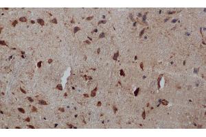 Immunohistochemistry of paraffin-embedded Human brain tissue using PIK3CB Polyclonal Antibody at dilution 1:50 (PIK3CB anticorps)