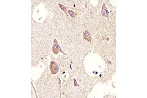 Immunohistochemical analysis of paraffin-embedded H.