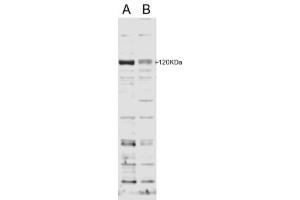 Western Blotting (WB) image for anti-SECIS Binding Protein 2 (SECISBP2) (Internal Region) antibody (ABIN2466241) (SECISBP2 anticorps  (Internal Region))