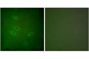 Immunofluorescence analysis of HeLa cells, using CARD6 Antibody.