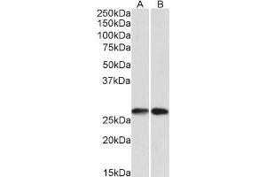 Western Blotting (WB) image for anti-Nicotinamide N-Methyltransferase (NNMT) antibody (ABIN5903827) (NNMT anticorps)