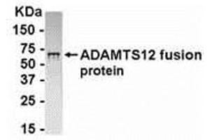 Western Blotting (WB) image for anti-ADAM Metallopeptidase with thrombospondin Type 1 Motif, 12 (ADAMTS12) (AA 297-446) antibody (ABIN2468193) (ADAMTS12 anticorps  (AA 297-446))