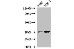 Western Blot Positive WB detected in: K562 whole cell lysate, MCF-7 whole cell lysate All lanes: EN2 antibody at 2. (EN2 anticorps  (AA 1-251))