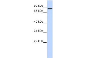 WB Suggested Anti-AMOT Antibody Titration:  0.