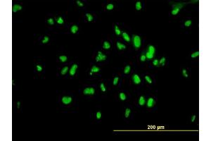 Immunofluorescence of monoclonal antibody to UBTF on HepG2 cell.