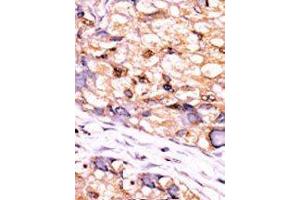 Image no. 2 for anti-CTD (Carboxy-terminal Domain, RNA Polymerase II, Polypeptide A) Small Phosphatase 1 (CTDSP1) (AA 1-250), (C-Term), (N-Term) antibody (ABIN360805)