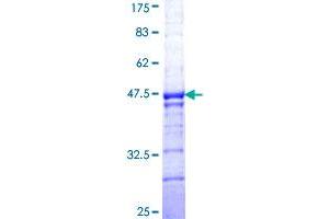 Image no. 1 for Basonuclin 1 (BNC1) (AA 599-705) protein (GST tag) (ABIN1346796) (Basonuclin 1 Protein (BNC1) (AA 599-705) (GST tag))
