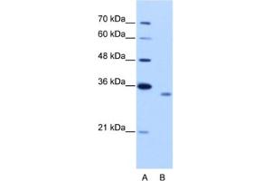 Western Blotting (WB) image for anti-RNA Binding Motif Protein 4B (RBM4B) antibody (ABIN2462313) (RBM4B anticorps)