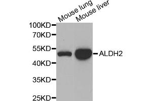 Western blot analysis of extracts of various cell lines, using ALDH2 antibody (ABIN5970568) at 1/1000 dilution. (ALDH2 anticorps)