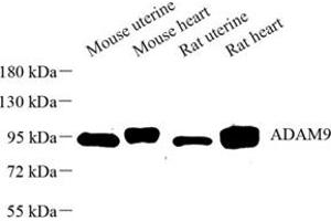 Western blot analysis of ADAM9 (ABIN7072943) at dilution of 1: 500 (ADAM9 anticorps)