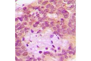 Immunohistochemistry (IHC) image for anti-serine Peptidase Inhibitor, Kunitz Type 1 (SPINT1) antibody (ABIN7308368)