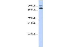 WB Suggested Anti-FOXK2 Antibody Titration:  0. (Forkhead Box K2 anticorps  (Middle Region))