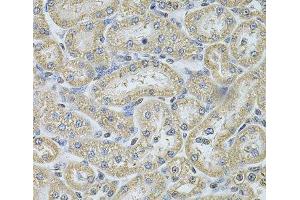 Immunohistochemistry of paraffin-embedded Rat kidney using IFI16 Polyclonal Antibody at dilution of 1:100 (40x lens).