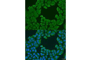 Immunofluorescence analysis of U2OS cells using STXBP3 antibody. (STXBP3 anticorps  (AA 343-592))