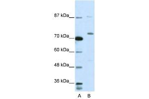 EXOSC10 antibody used at 5 ug/ml to detect target protein. (EXOSC10 anticorps  (C-Term))