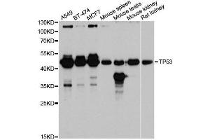 Western blot analysis of extracts of various cell lines, using TP53 antibody. (p53 anticorps  (AA 1-100))