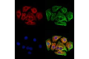 ABIN6261019 and ABIN6273216 staining Hela cells by IF/ICC. (CRAT anticorps  (N-Term))
