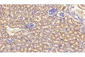 Detection of C3 Convertase in Mouse Kidney Tissue using Polyclonal Antibody to Complement C3 Convertase (C3 Convertase) (Complement C3 Convertase anticorps)