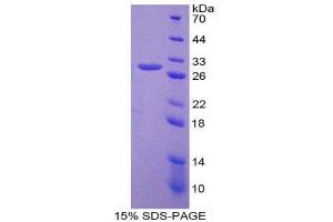 SDS-PAGE (SDS) image for Nucleoporin 155kDa (NUP155) (AA 1154-1379) protein (His tag) (ABIN1879633)
