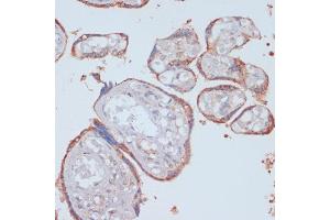 Immunohistochemistry of paraffin-embedded human placenta using LRP1 antibody (ABIN3021968, ABIN3021969, ABIN3021970 and ABIN6218530) at dilution of 1:100 (40x lens). (LRP1 anticorps  (AA 20-270))