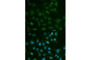 Immunofluorescence analysis of MCF7 cell using ABO antibody. (ABO anticorps  (AA 54-354))